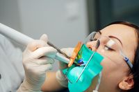 избелване на зъби - 66513 отстъпки