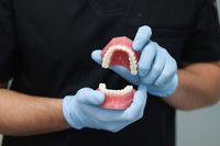 избелване на зъби - 1547 снимки